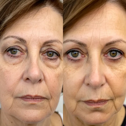 EyeLift Pro™ 2-in-1 Red Light Therapy + EMS Eye Rejuvenator