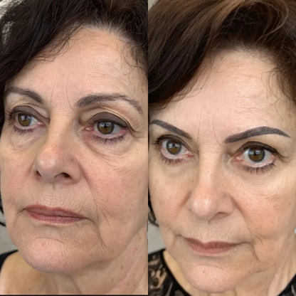 EyeLift Pro™ 2-in-1 Red Light Therapy + EMS Eye Rejuvenator